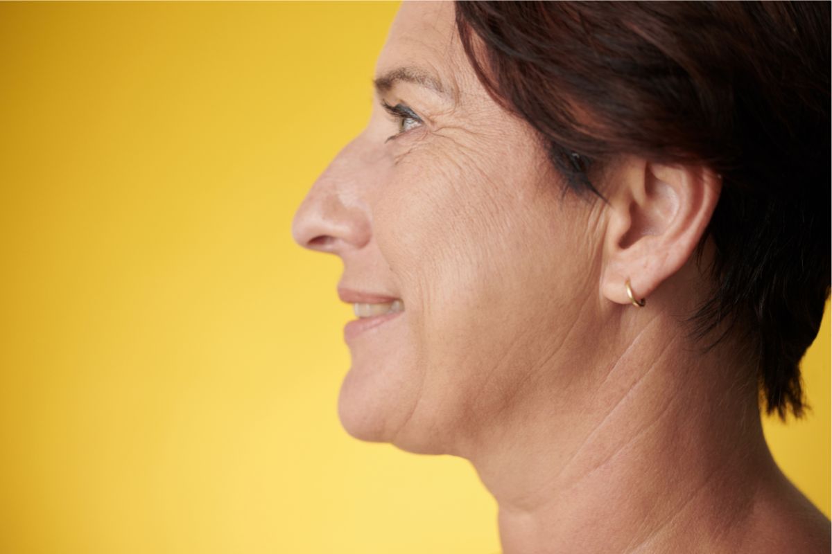 The woman has jowls.