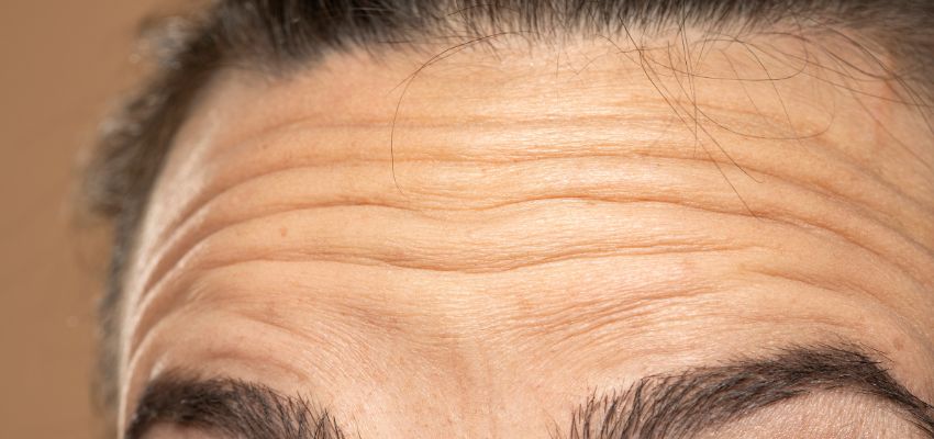 A forehead wrinkles.