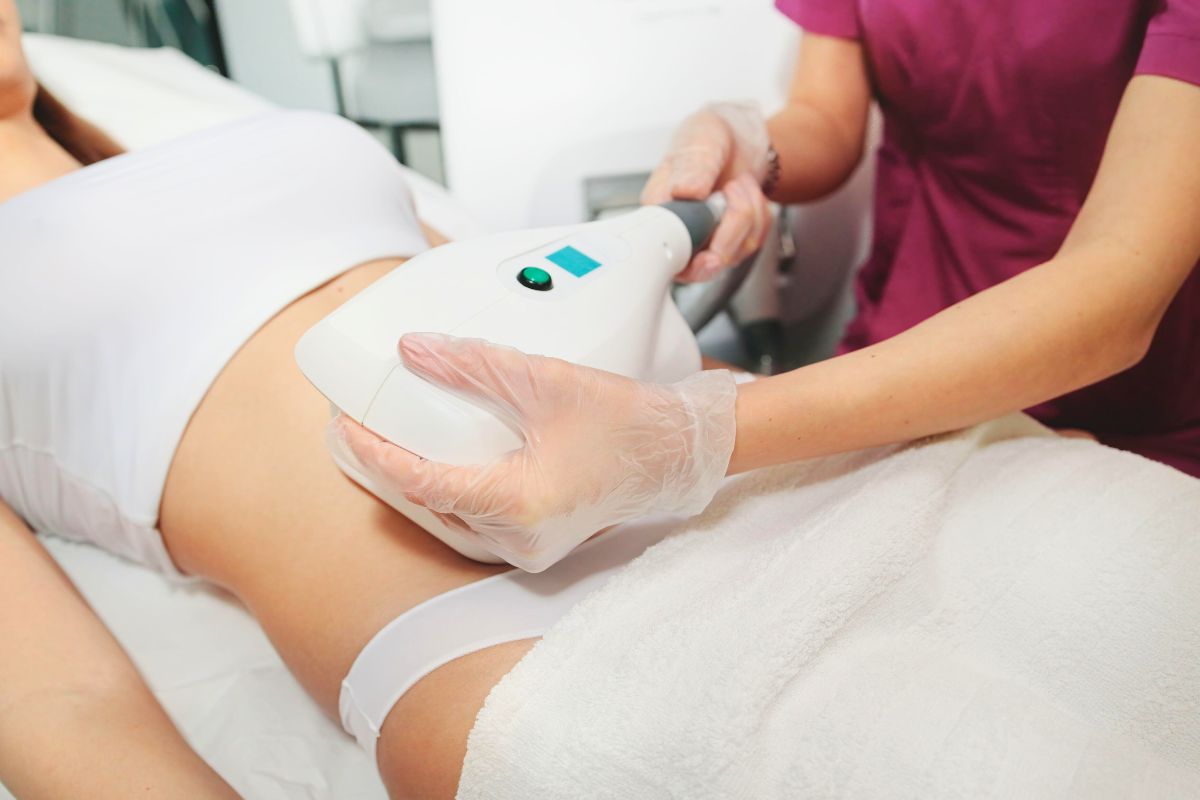 CoolSculpting treatment for reducing stubborn belly fat in a clinic setting.