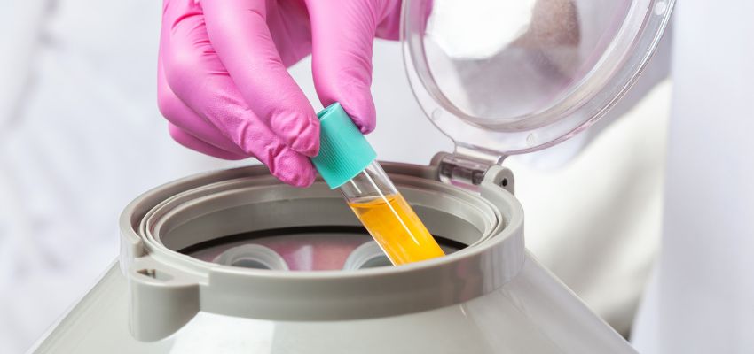 Laboratory preparation of platelet rich fibrin with a test tube placed in a centrifuge.