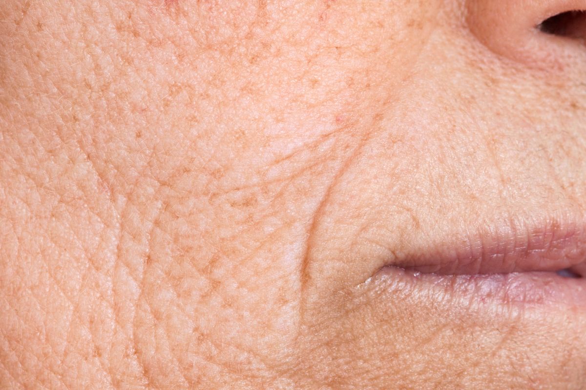 The woman has many wrinkles on her face.