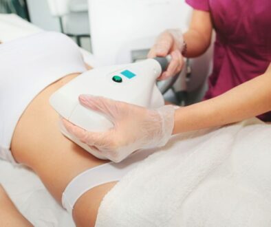 CoolSculpting treatment for reducing stubborn belly fat in a clinic setting.